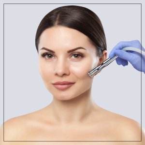 Laser Pigment Reduction Near Me in Frisco, TX
